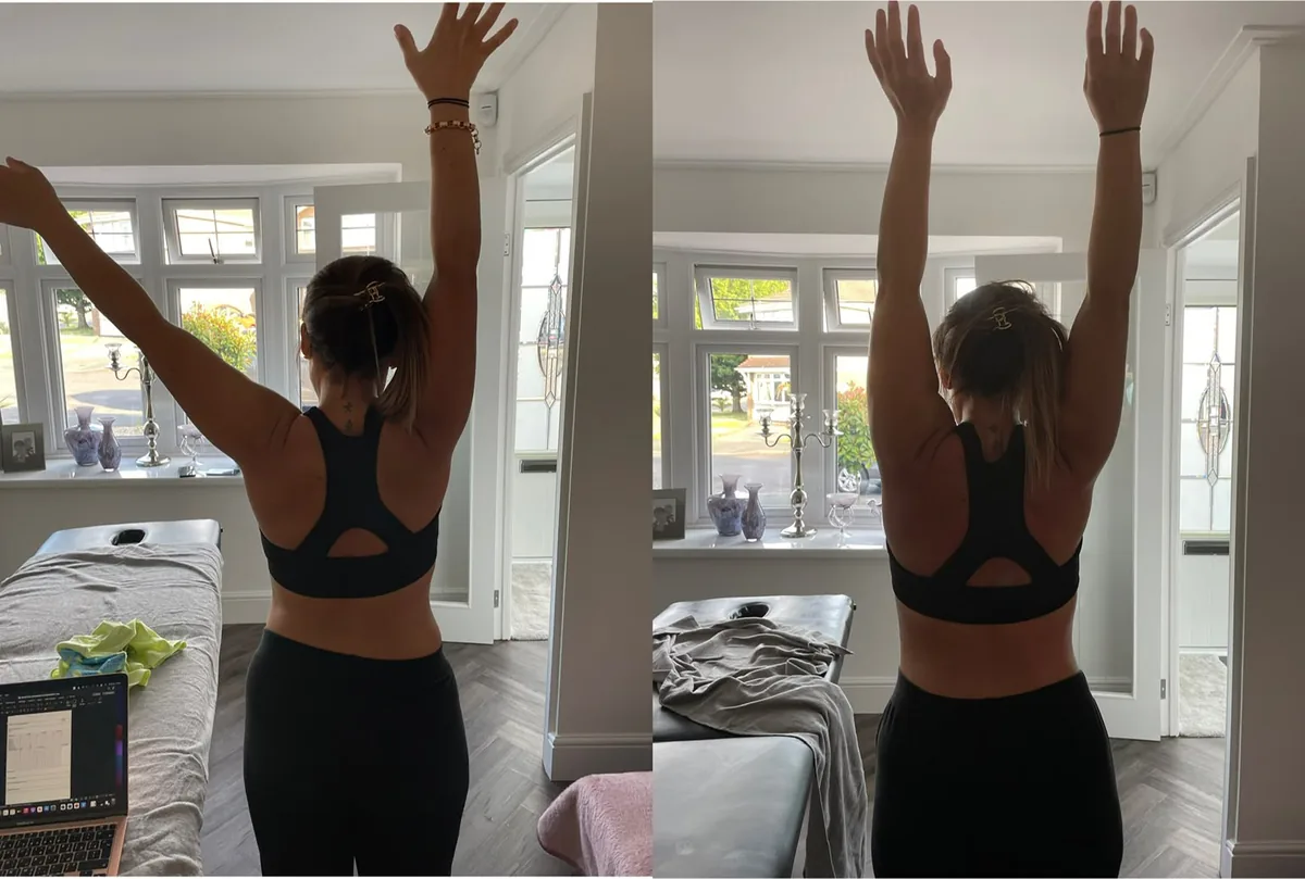 Two-panel comparison of a client's overhead arm raise before and after a course of treatment