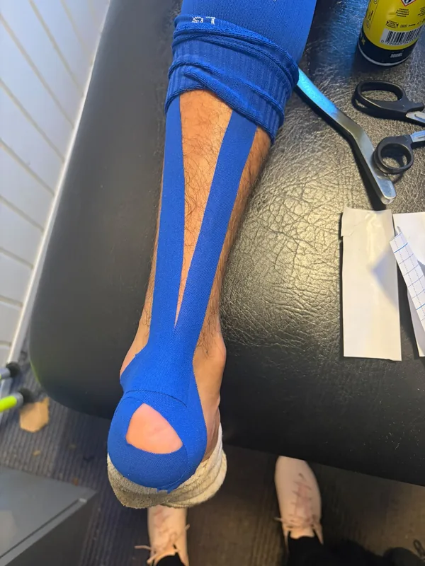 Blue kinesiology tape running the length of a client's calf and ankle