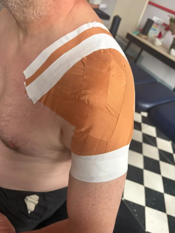 Rigid strapping tape applied across a client's shoulder and upper arm