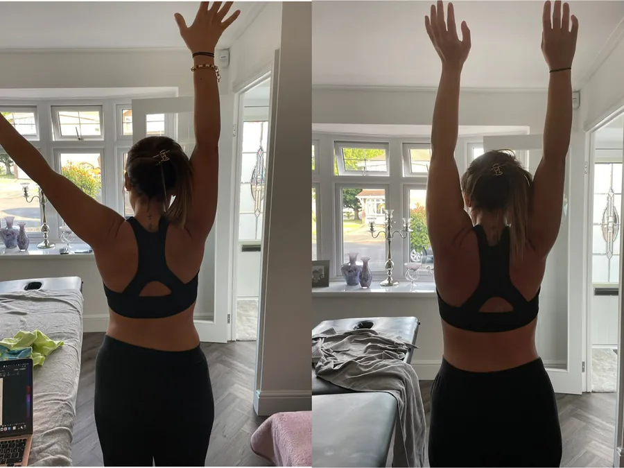 Two-panel movement screen showing overhead reach being reassessed in the treatment room